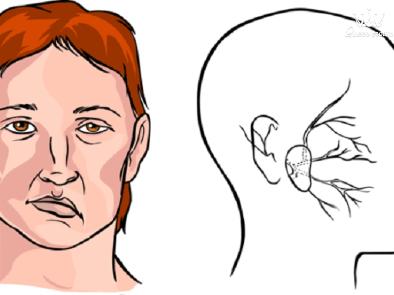 cách massage mặt bị lệch