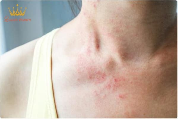 50 triệu chứng hậu covid