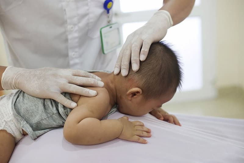 bài tập chữa vẹo cổ cho bé
