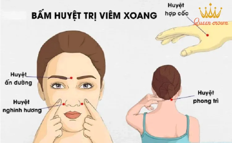 bấm huyệt chữa viêm xoang