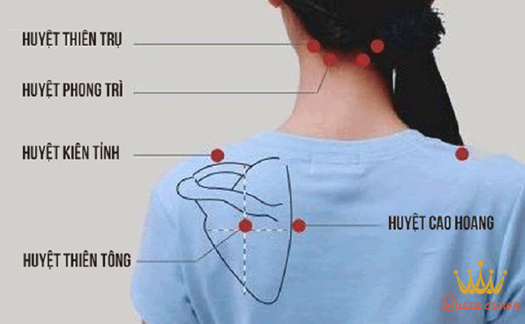 cách bấm huyệt chữa đau vai gáy