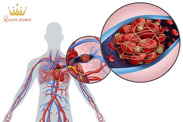 cách chữa hậu covid