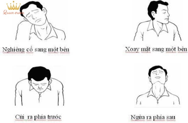 cách trị đau mỏi cổ vai gáy