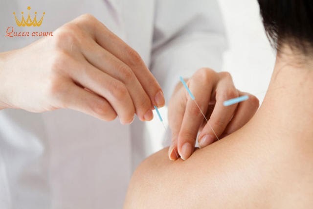 cách trị đau vai gáy tại nhà