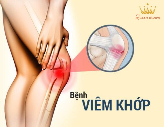 cách trị nhức mỏi tay chân tại nhà