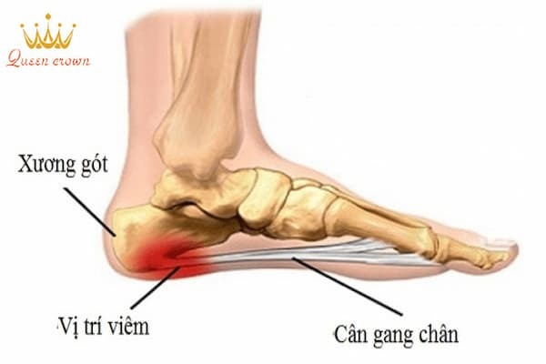 Chấn thương thể thao   