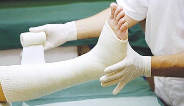 dấu hiệu gãy xương