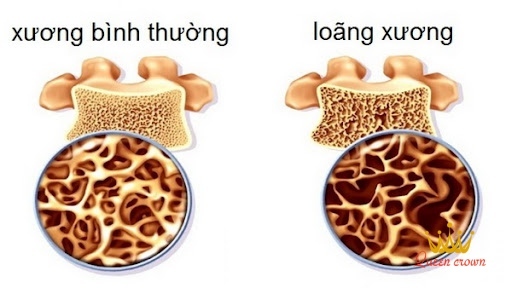 đau nhức xương khớp ở người già