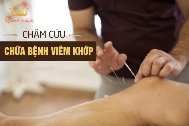 khô khớp ở người trẻ