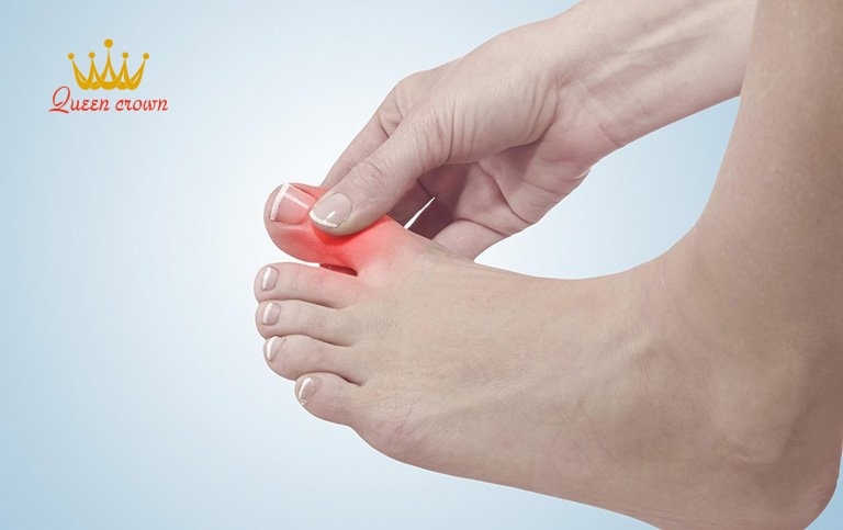 đau nhức xương khớp ở người trẻ