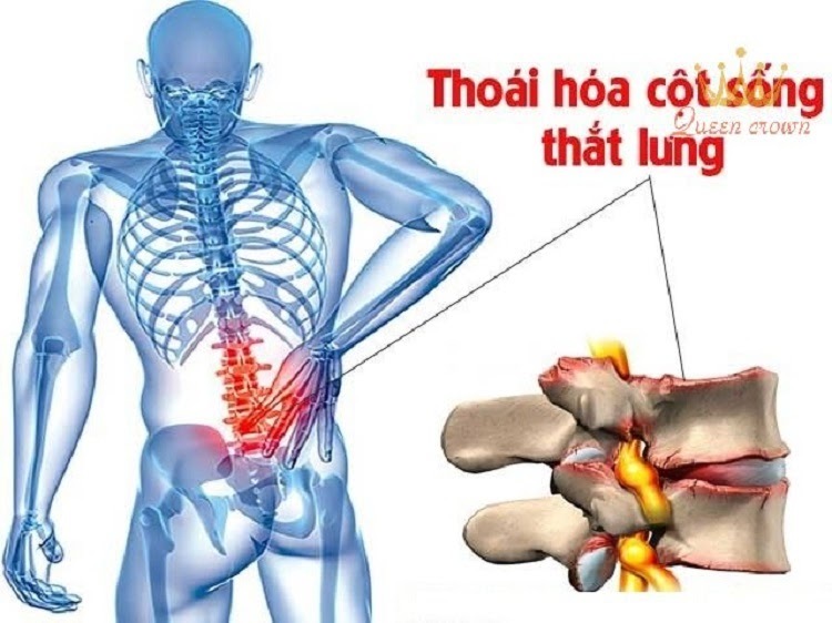 Ghế massage giá rẻ 360 đẩy lùi thoái hóa cột sống