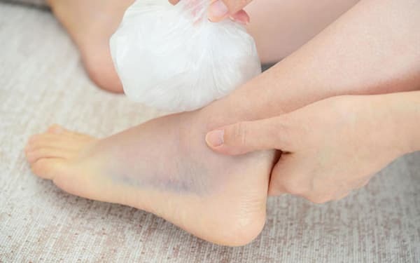 hình ảnh chân bị bong gân