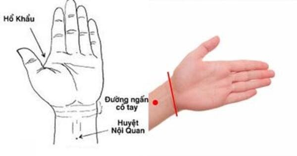 vị trí huyệt nội quan
