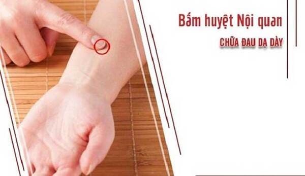 huyệt nội quan hỗ trợ đau dạ dày