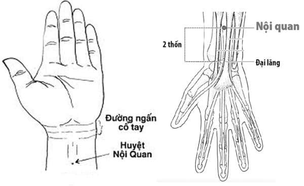 huyệt nội quan