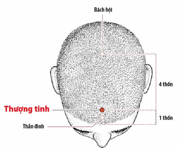 huyệt thượng tinh