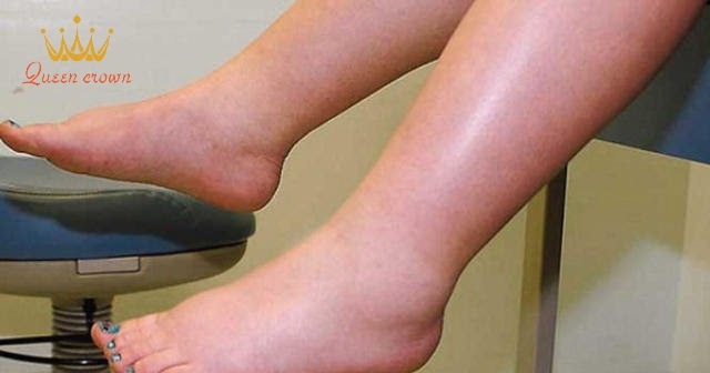 nguyên nhân bị phù chân ở người già