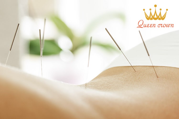 Huyệt là gì? Bấm huyệt có những tác dụng gì? 3 Huyệt trên đường kinh là các huyệt để châm cứu